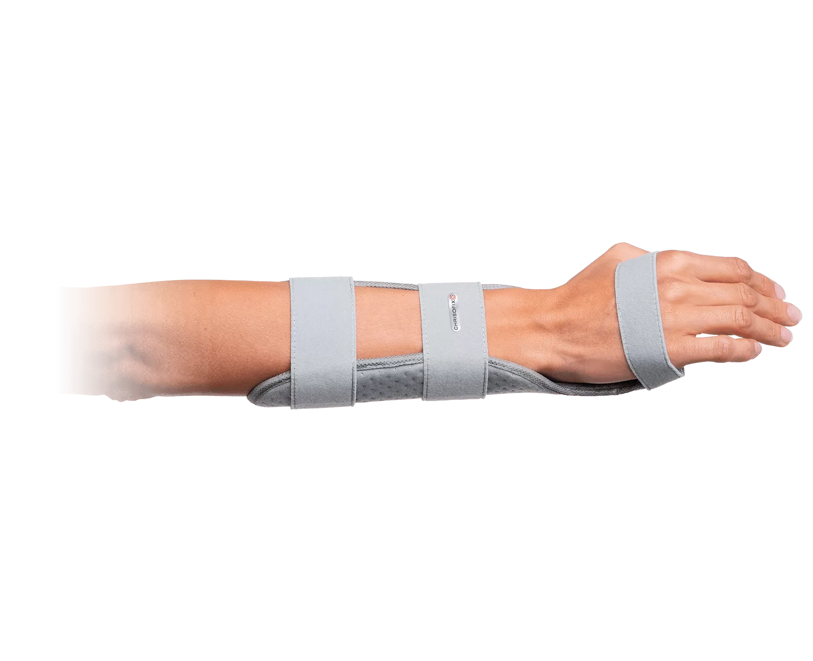 Chrisofix Volar wrist orthosis