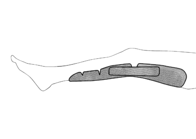 Universal resting orthosis for knee (disinfectable shell) – REF_76