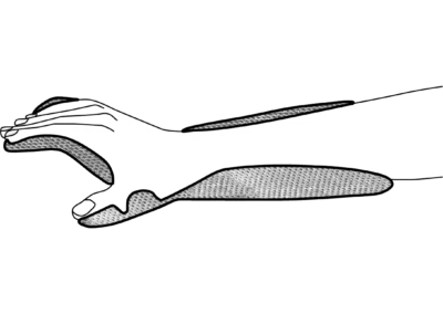 Orthosis for paresis (wrist & hand & thumb) (disinfectable shell) – REF_73-74