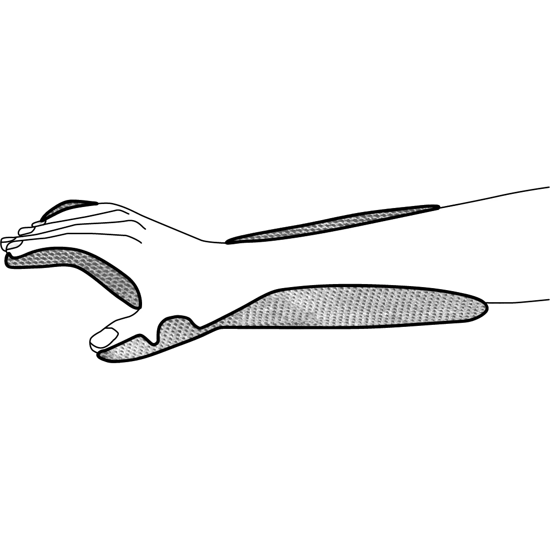 Chrisofix Orthosis for paresis (wrist & hand & thumb) – disinfectable shell