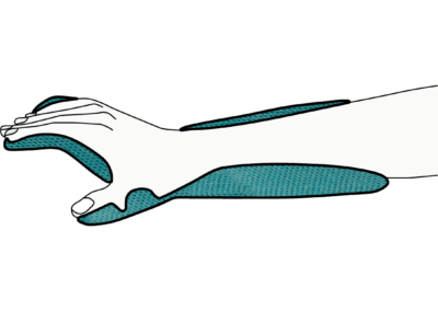 Orthosis for paresis (wrist & hand & thumb) (disinfectable shell)