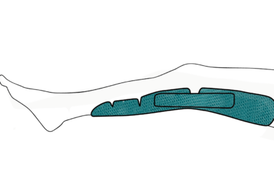 Universal resting orthosis for knee (disinfectable shell)