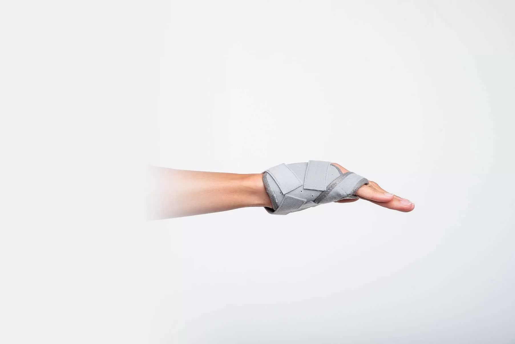Side view of a fifth metacarpal fracture orthosis on the hand