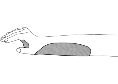 Volar wrist orthosis (disinfectable shell) – REF_70