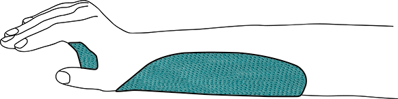 ref_70_shell_REUSABLE_SMALL Volar wrist orthosis