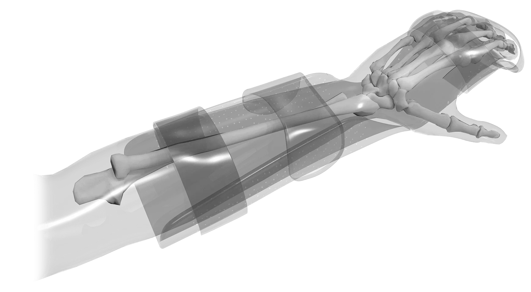 Chrisofix - World-class Orthoses Developed and Patented in Switzerland